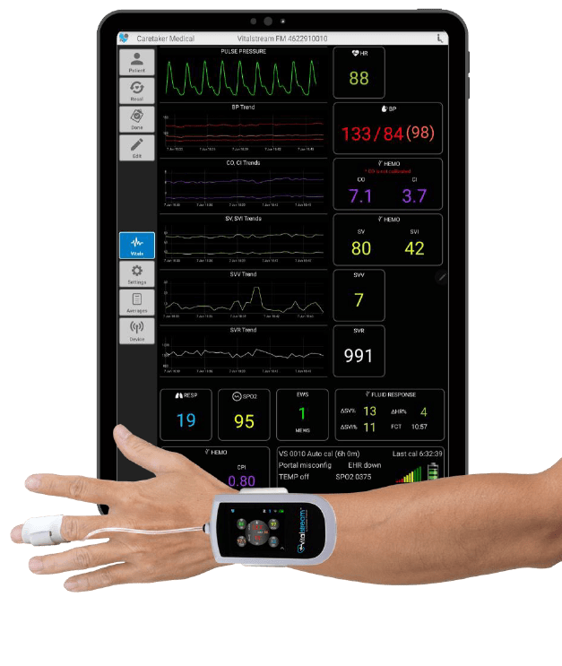 VitalStream wearable sensor and real-time monitoring display